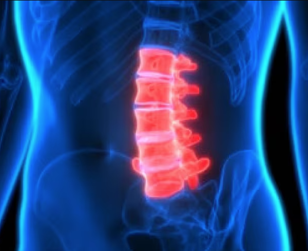 Convegno | Indicazioni e limiti degli  approcci anteriori al rachide lombare