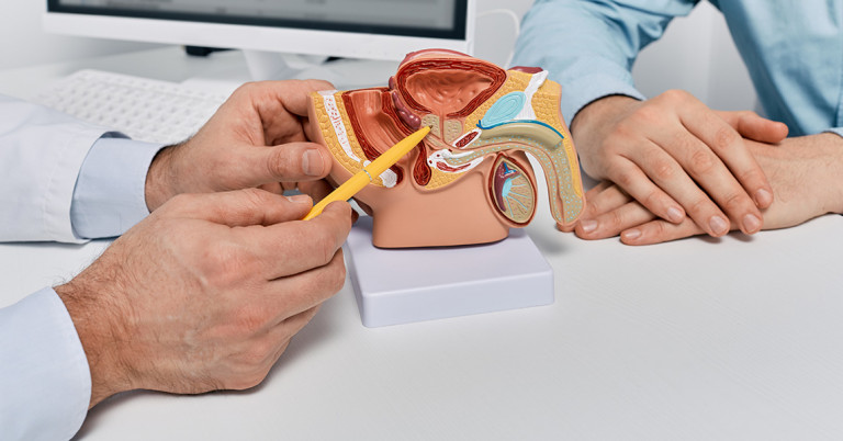 Tumore alla prostata