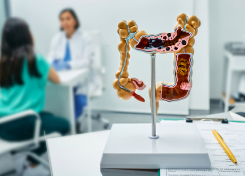 Screening per il tumore al colon-retto: tutto quello che c’è da sapere