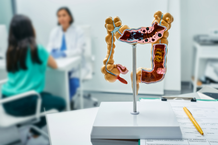 Screening per il tumore al colon-retto: tutto quello che c’è da sapere