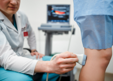 Vene varicose: come eliminarle?