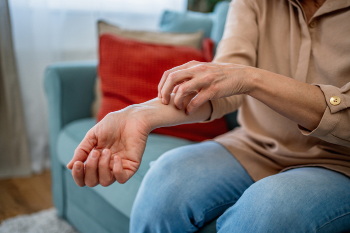 Psoriasi e intestino: quale legame?