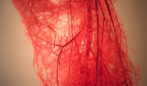 Casa di Cura Barbantini<br>L’insufficienza venosa e le sue complicanze