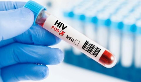 Cos’è la PEP per HIV