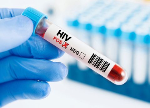 Cos’è la PEP per HIV