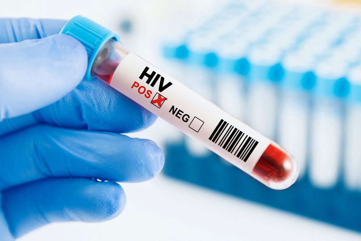Cos’è la PEP per HIV